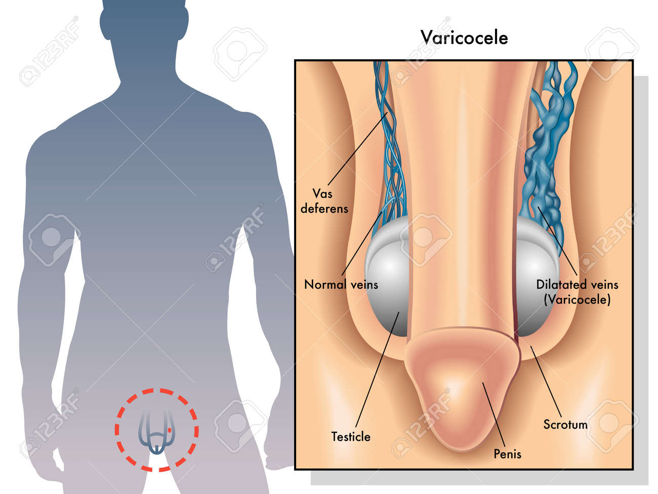 penis verdovingsspray