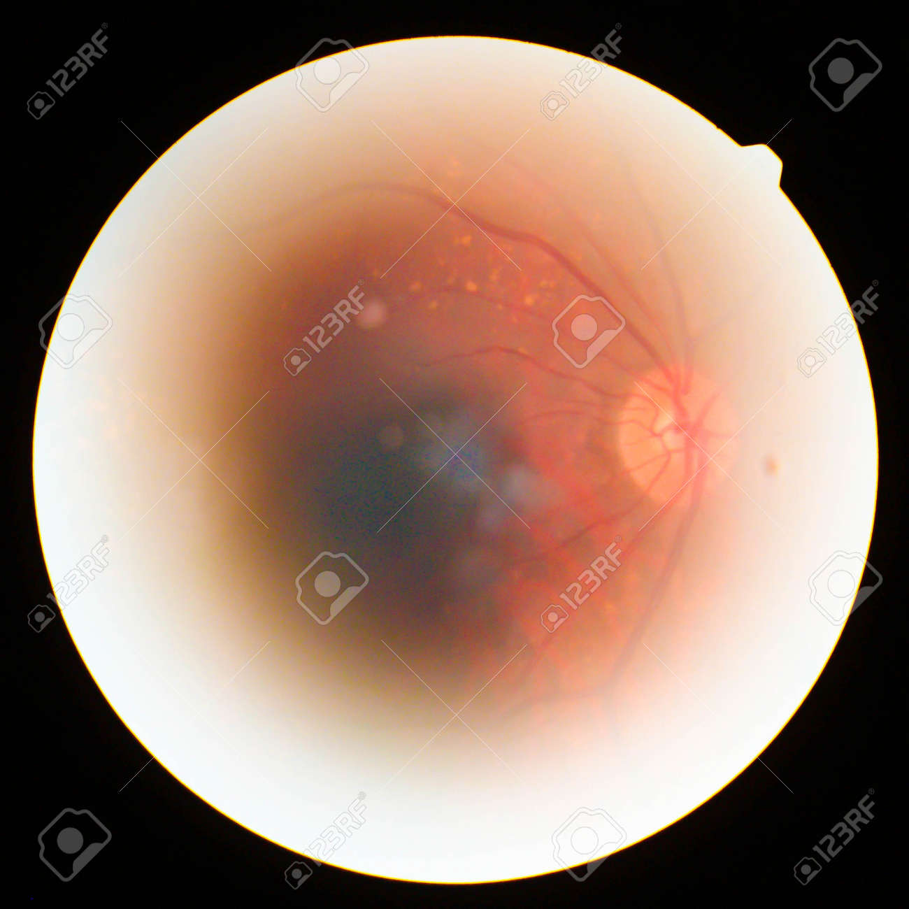 etiam-dictum-ipsum-a-felis