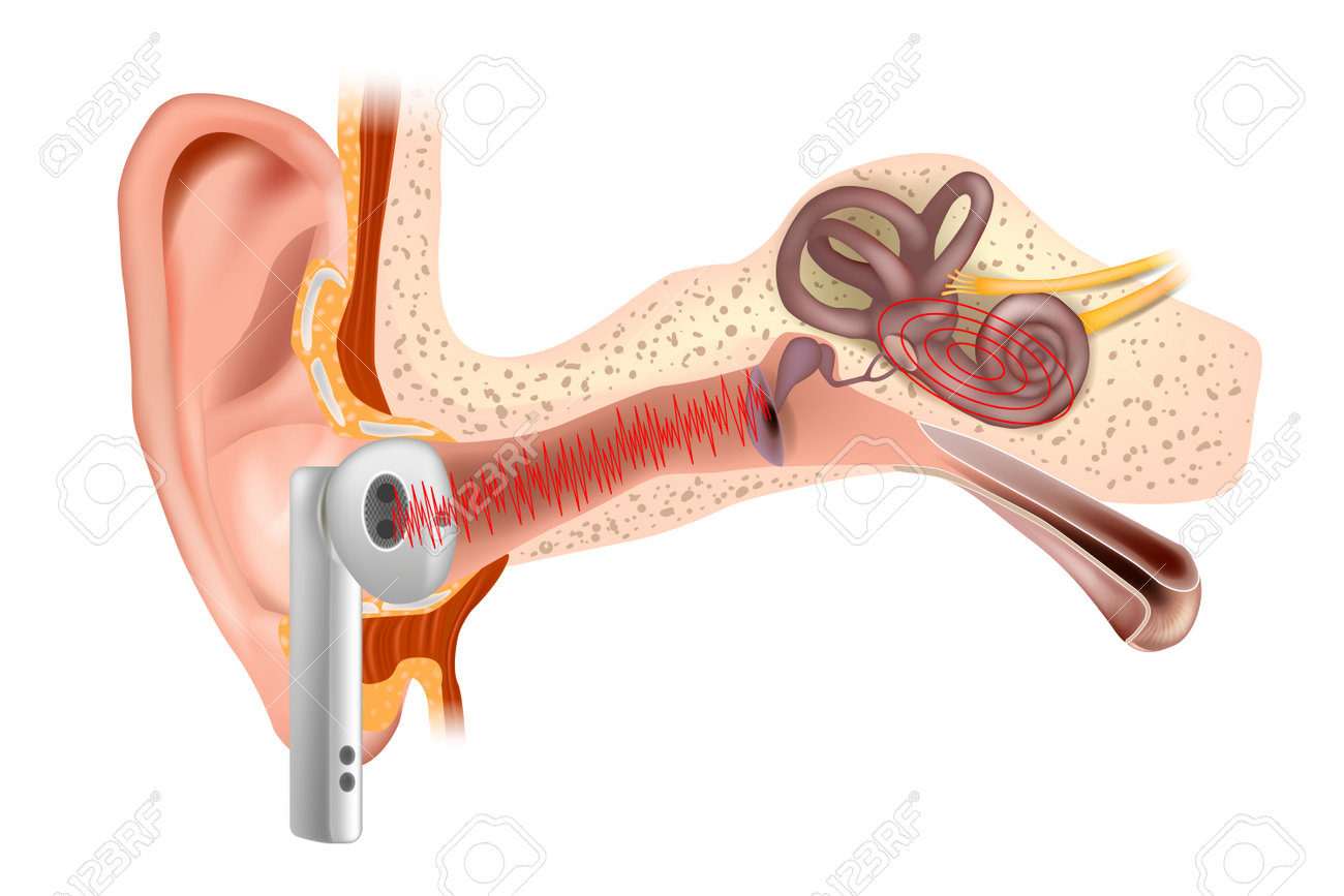 Daño Auditivo En El Oído Interno Pérdida De Audición El Sonido Fuerte De  Los Auriculares De Vacío Daña El Oído Interno Ilustraciones svg,  vectoriales, clip art vectorizado libre de derechos. Image 213957460
