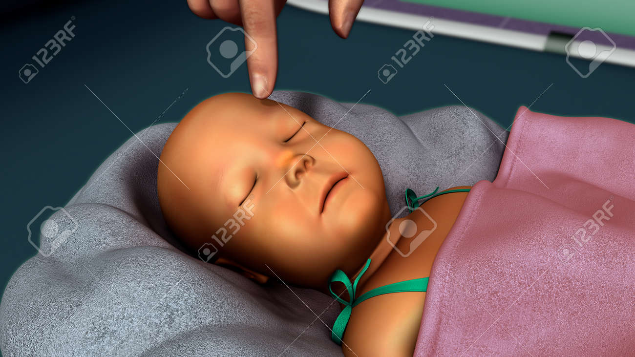 黄疸は新生児 の写真素材 画像素材 Image