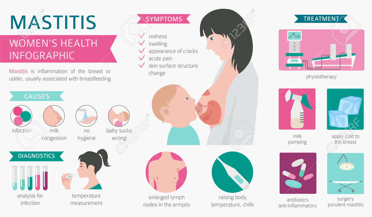 Mastitis Breastfeed Medical Infographic Diagnostics Symptoms Treatment Women S Health Icon Set Vector Illustration Royalty Free Cliparts Vectors And Stock Illustration Image 103941488