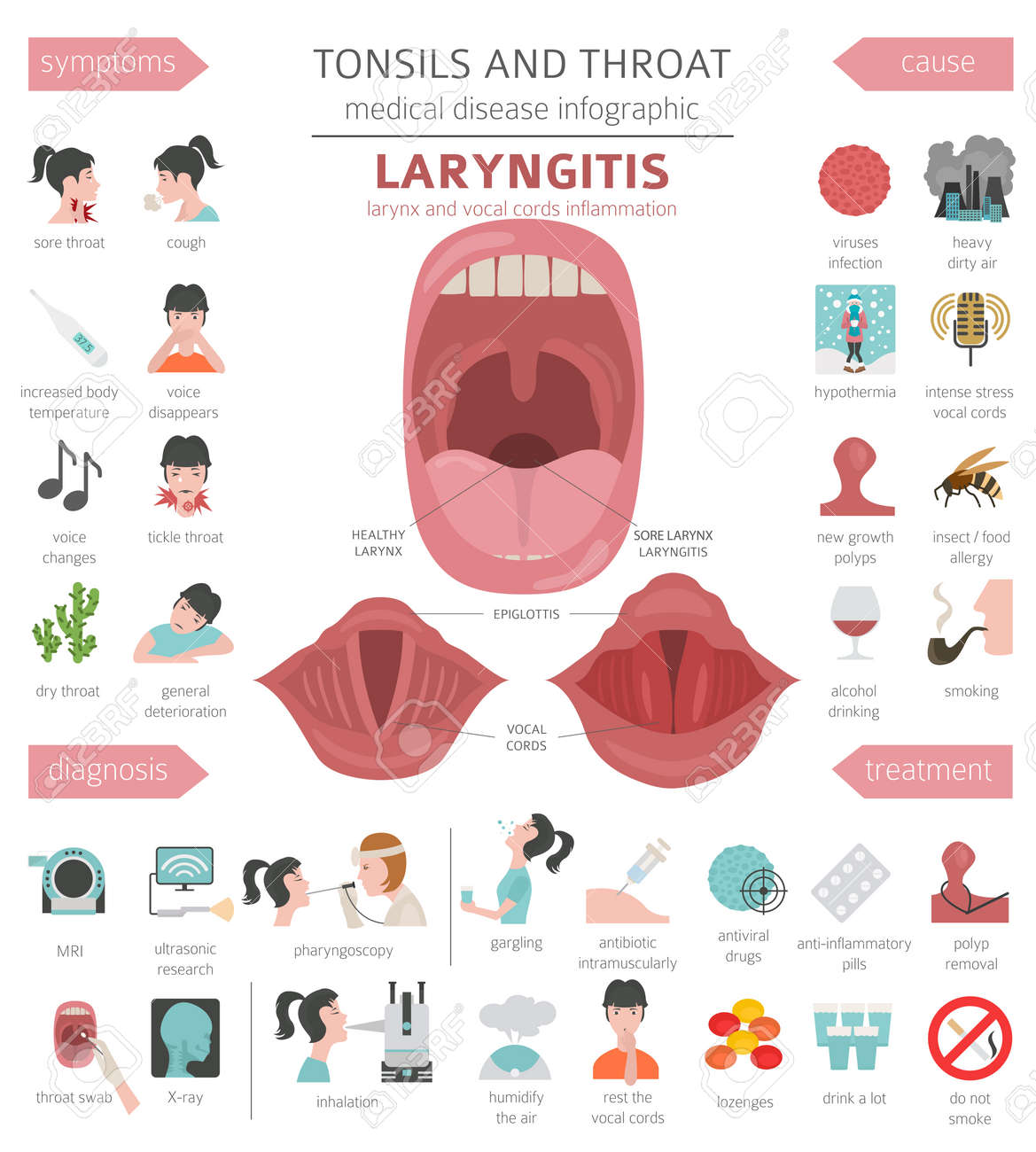 Tonsils and throat diseases. Laryngitis symptoms, treatment icon set. Medical infographic design. Vector illustration - 128503135 Tonsils and throat diseases. Laryngitis symptoms, treatment icon set. Medical infographic design. Vector illustration - 128503135