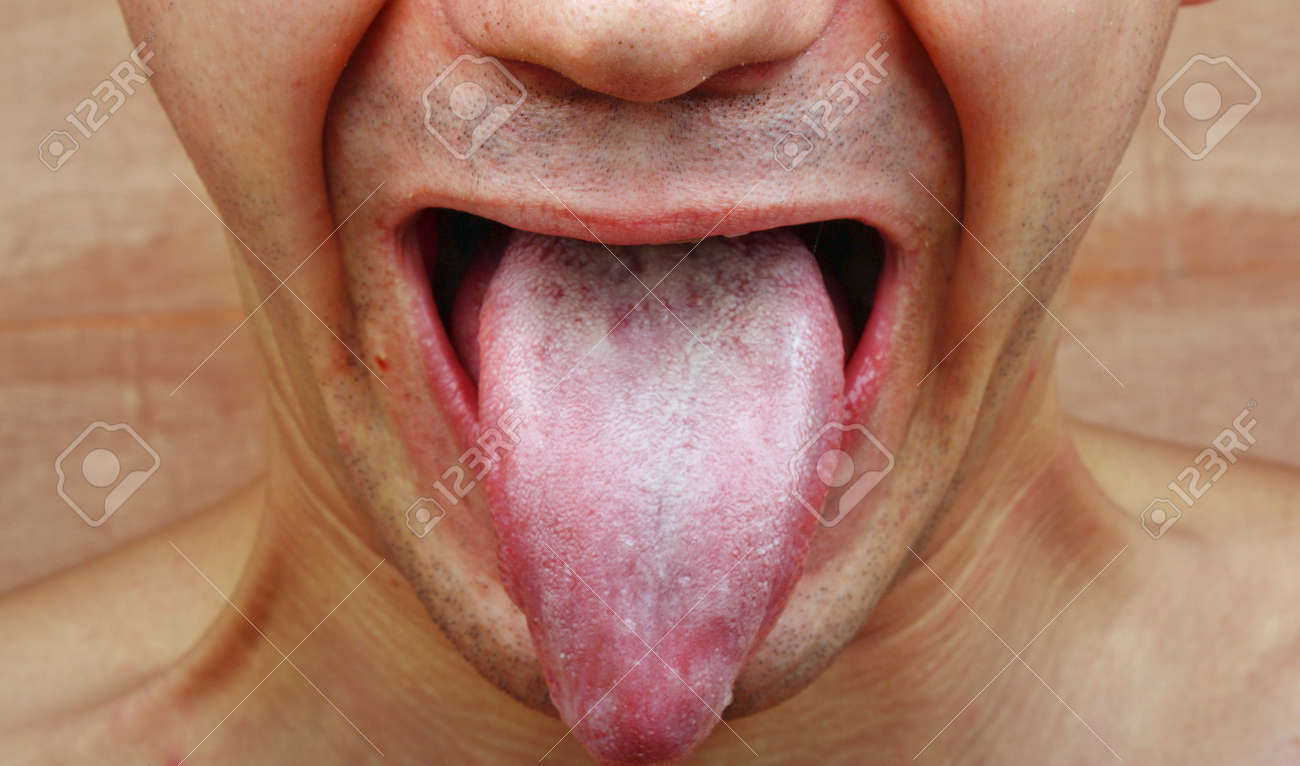 candida images Fotografías