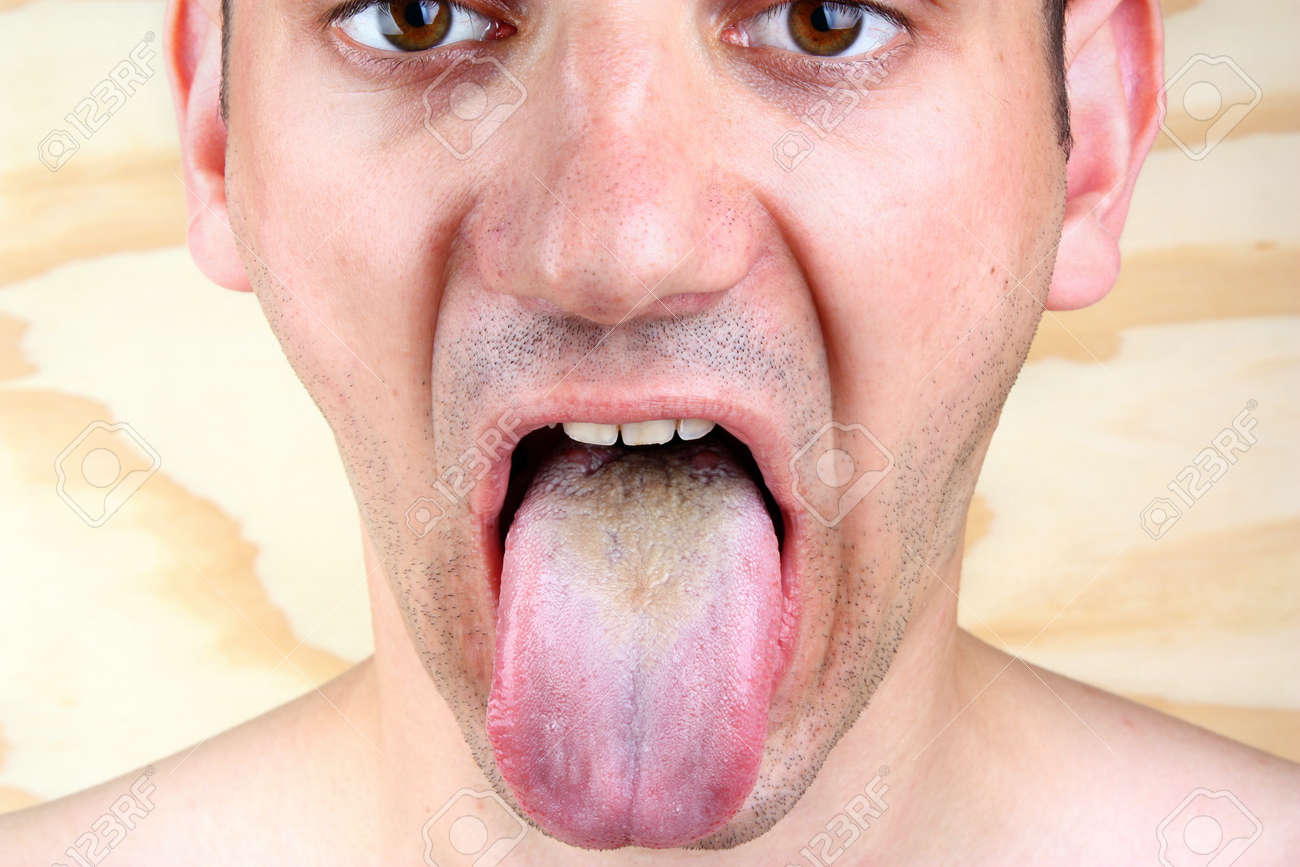 Oral Herpes: Symptoms, Treatment of Cold Oral Herpes: Symptoms, Treatment of Cold