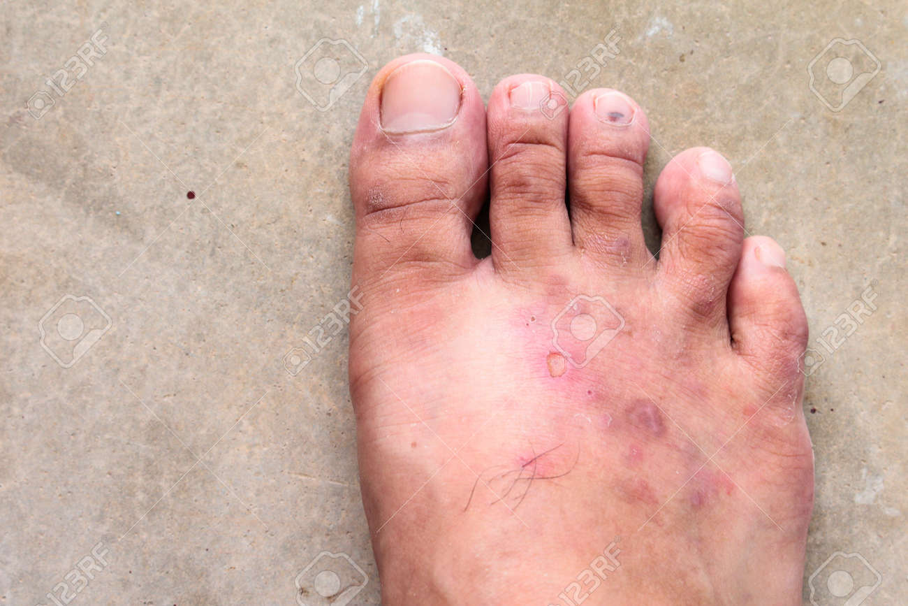 champignon au pied champignon au pied