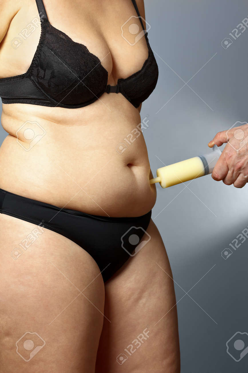 cellulite pancia