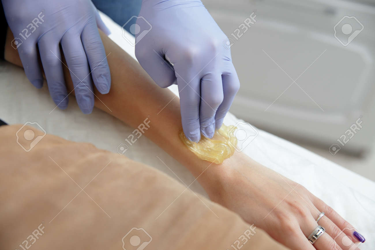 Beautician Removes Hair From A Woman S Hand Sugaring Hair