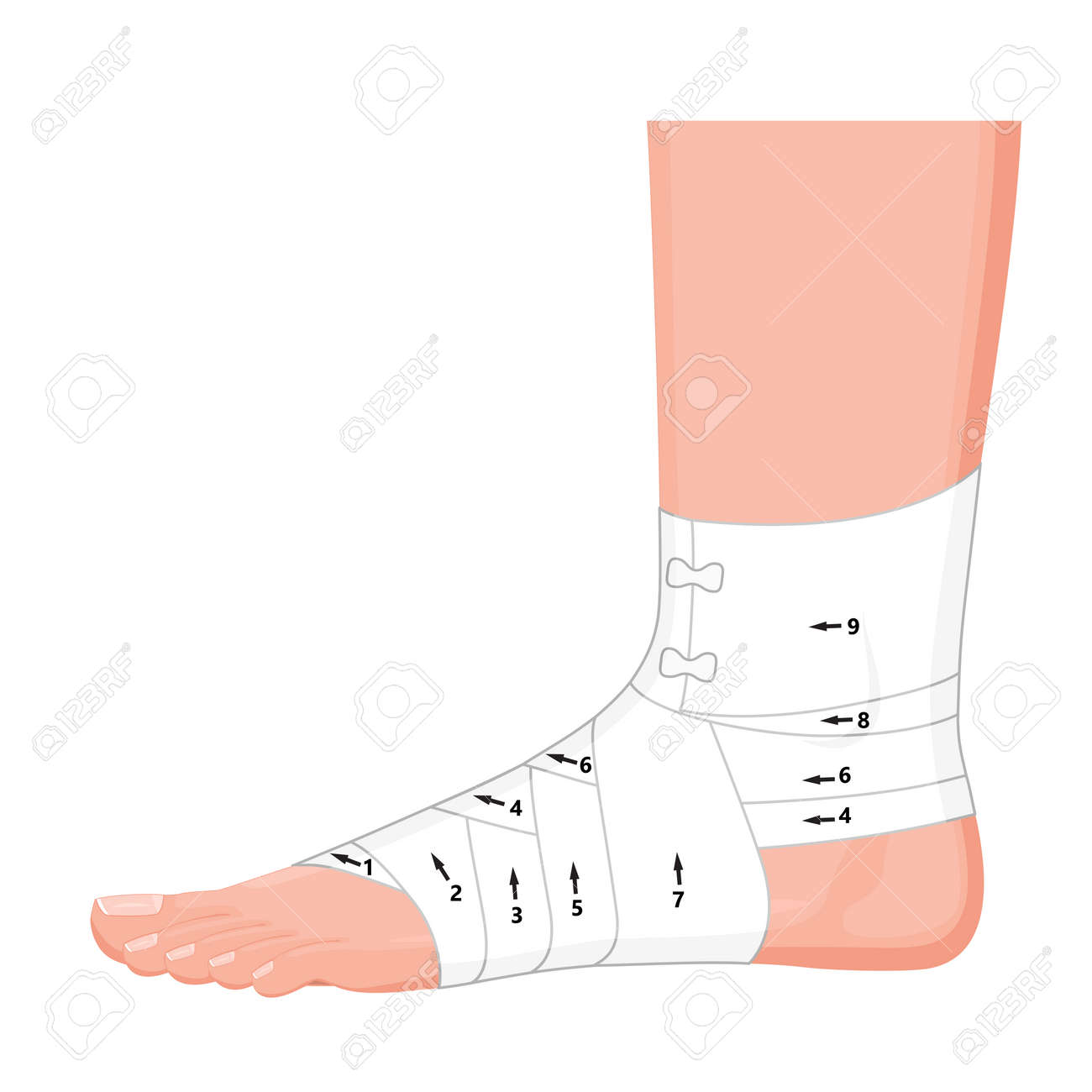 ベクトルの図 柔軟の弾性支持整形外科包帯 捻挫 ひずみ によって人間の足首をラップする正しい方法は 側面図 広告 医療出版物 Eps 8 のイラスト素材 ベクタ Image