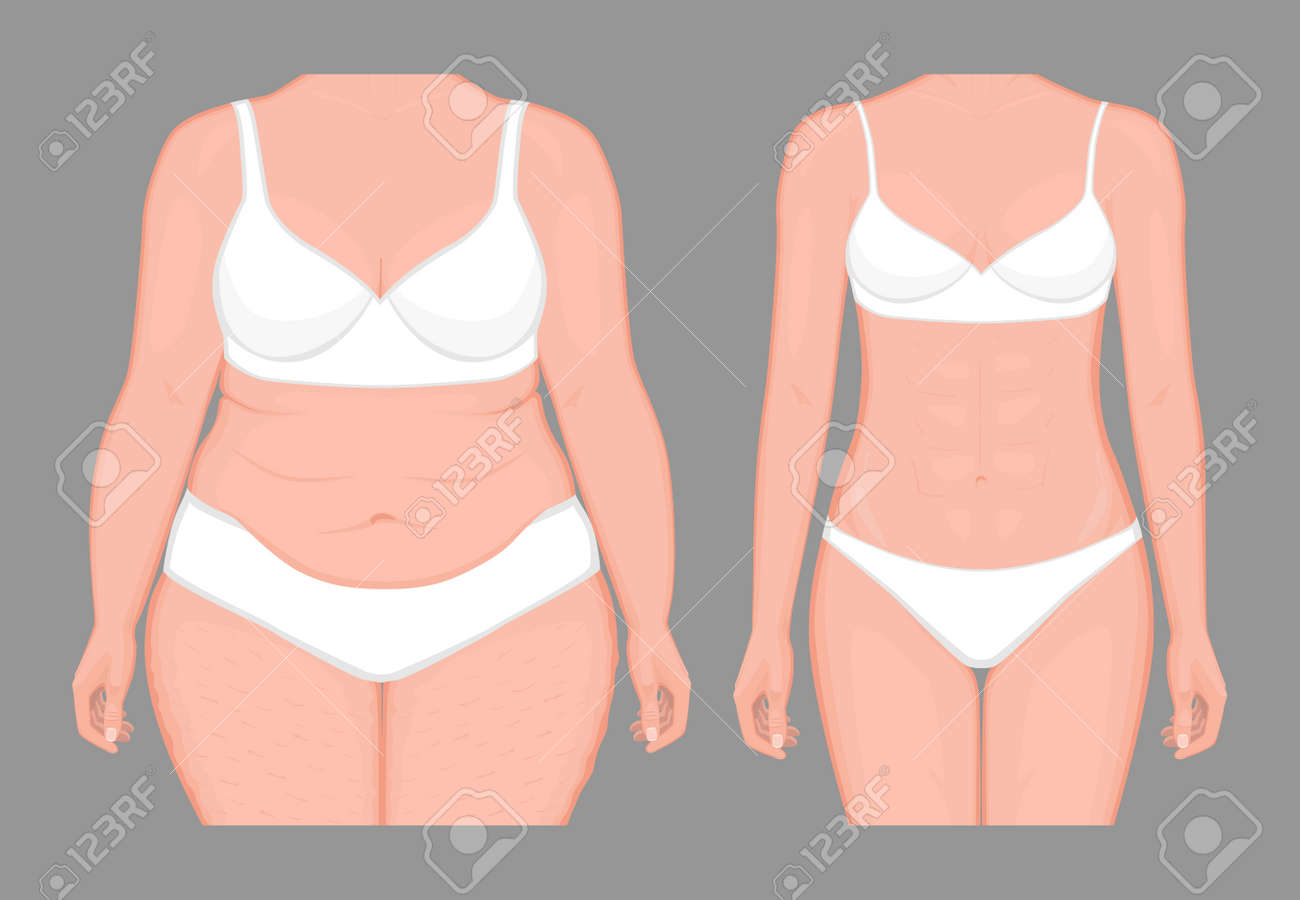 通常のスリムな体型に女性問題脂肪腹体重減少のベクター イラストです のイラスト素材 ベクタ Image