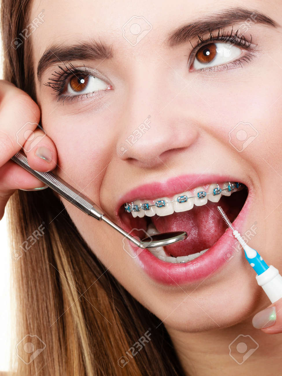 Dentist Appointment Braces  - Make A Note Of Your Appointments And Follow.