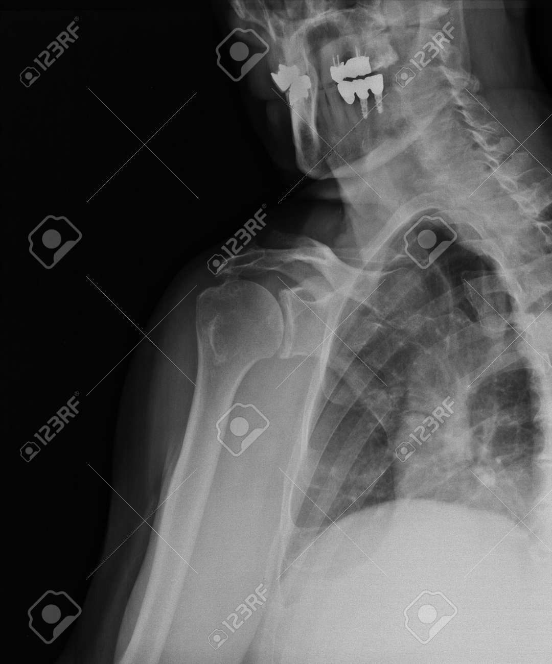 etiam-dictum-ipsum-a-felis