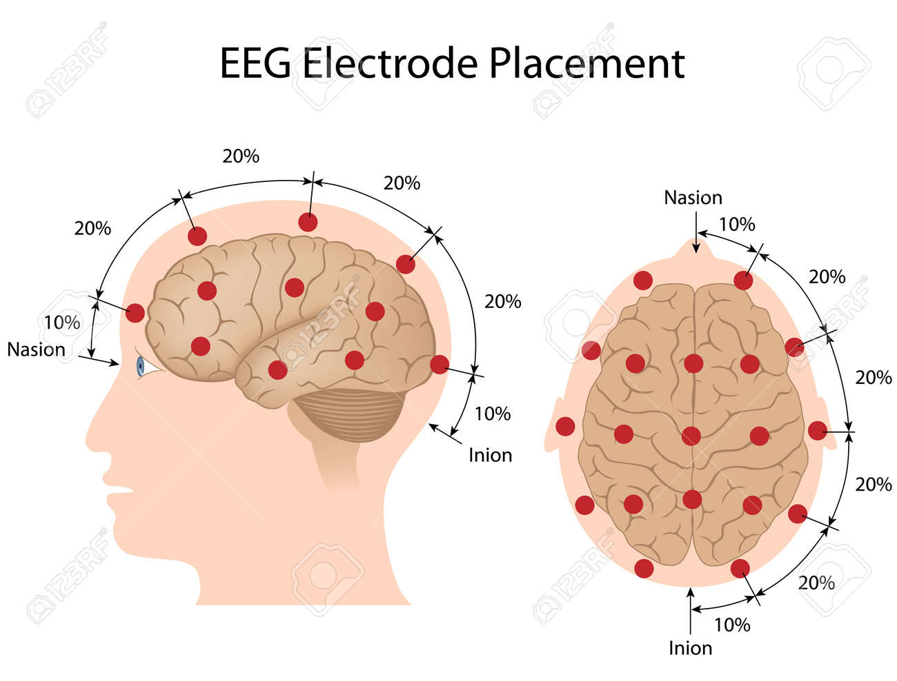 eeg electrode placement royalty free cliparts vectors and stock