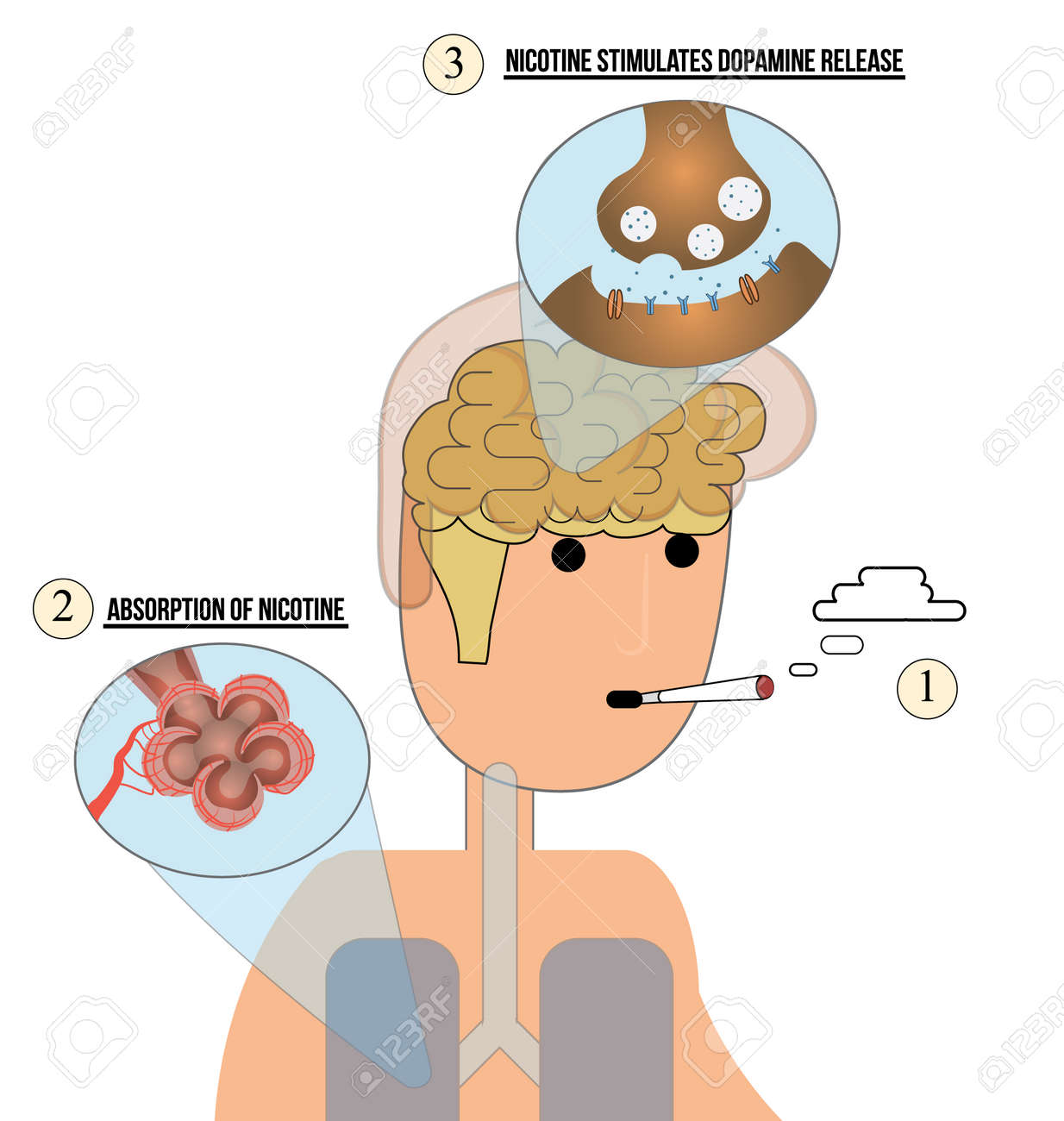 Nicotine addiction Nicotine addiction