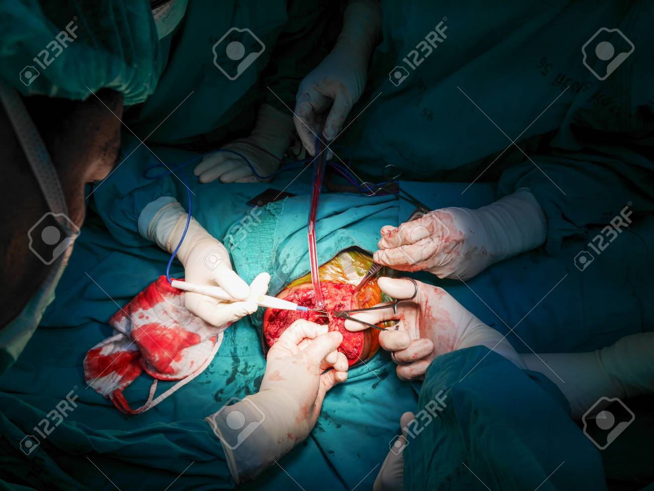 etiam-dictum-ipsum-a-felis