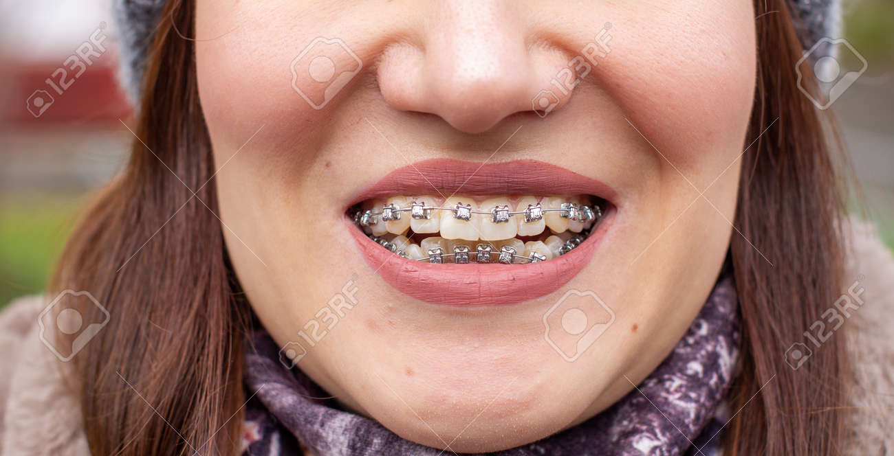 девочки mouth 