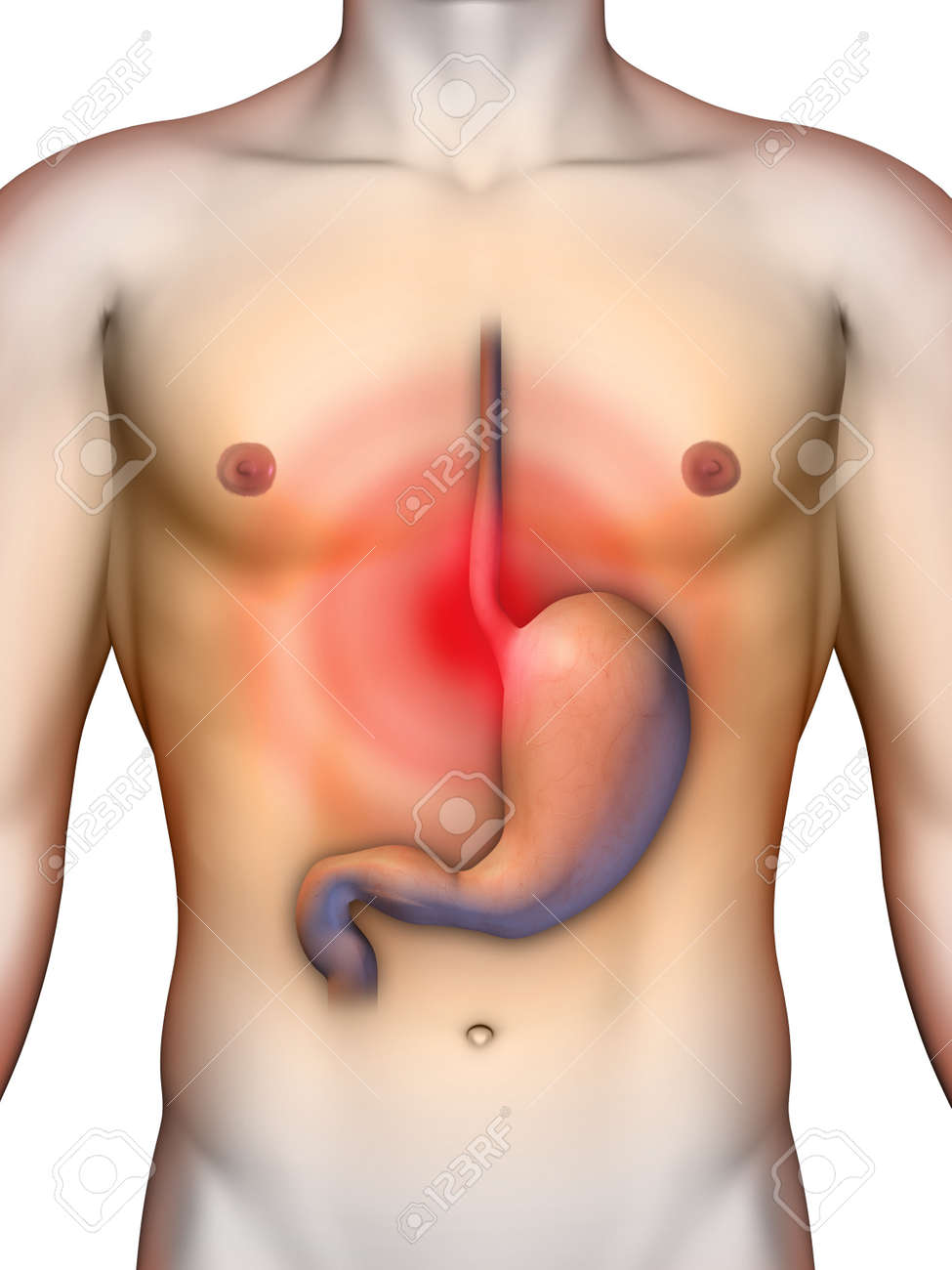 Acid Reflux From Stomach Causing Chest Pain Digital Illustration stock illustration