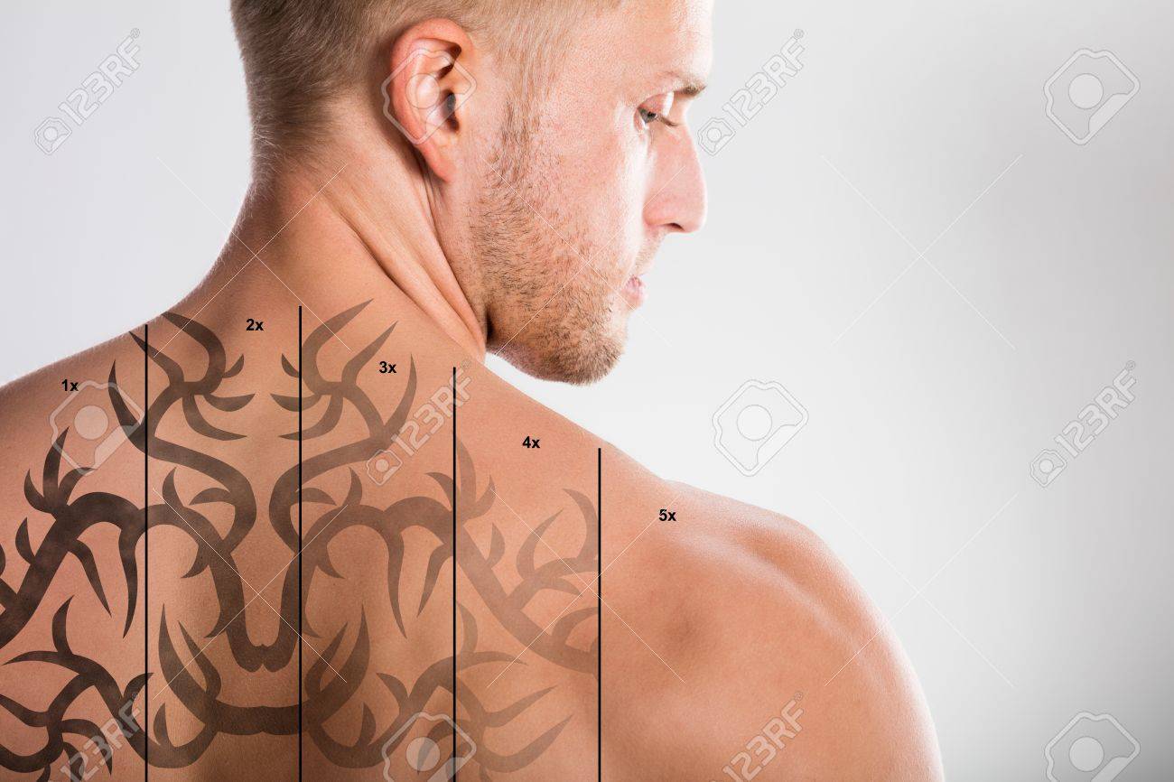 上半身裸の男の灰色の背景に対してのタトゥー除去します の写真素材 画像素材 Image