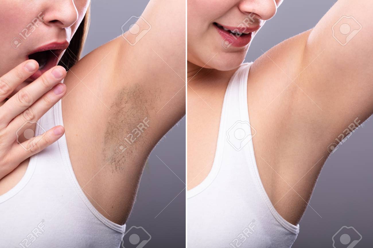 Depilacion de las axilas hotsell