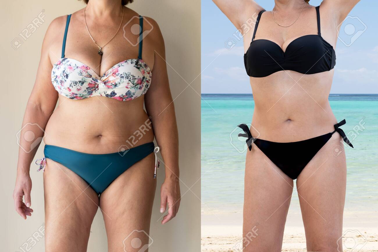 Mujer Madura Antes Y Después De Pie Gordo Delgado Fotos, Retratos, Imágenes Y Fotografía De Archivo Libres De Derecho. Image 140695462.
