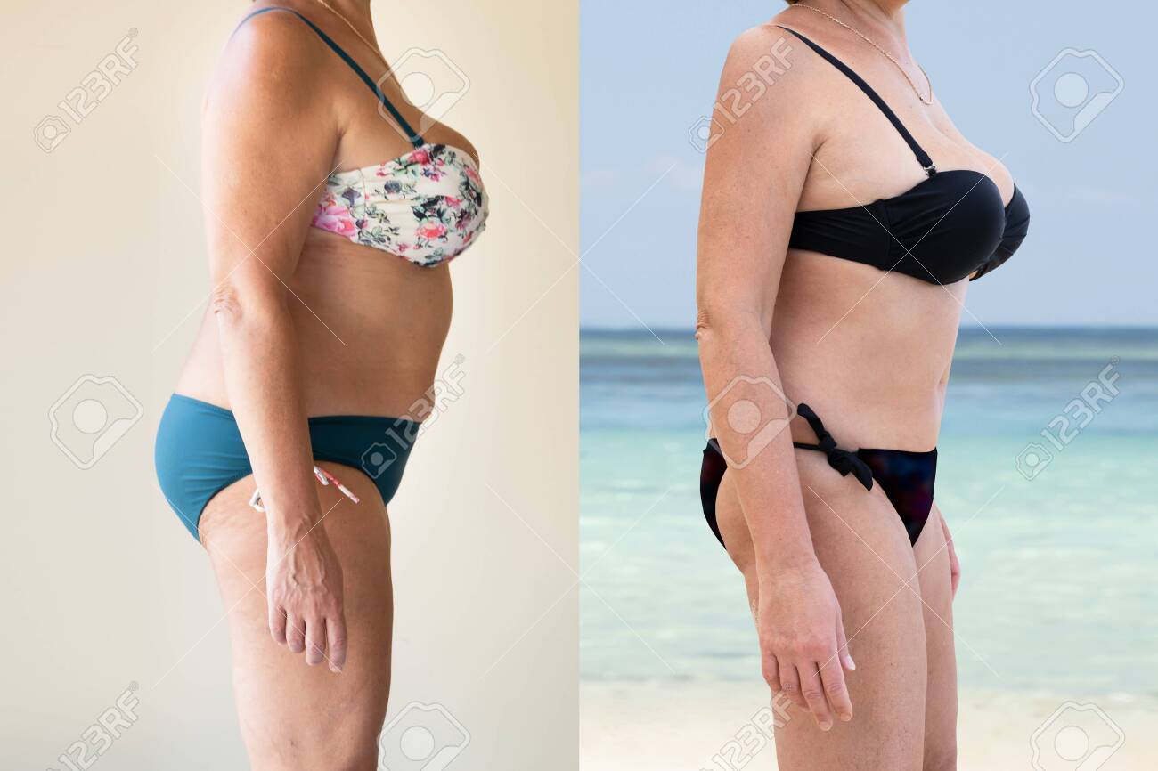 Mature Woman Before And After From Fat To Slim Concept Standing Stock  Photo, Picture and Royalty Free Image. Image 141637622.