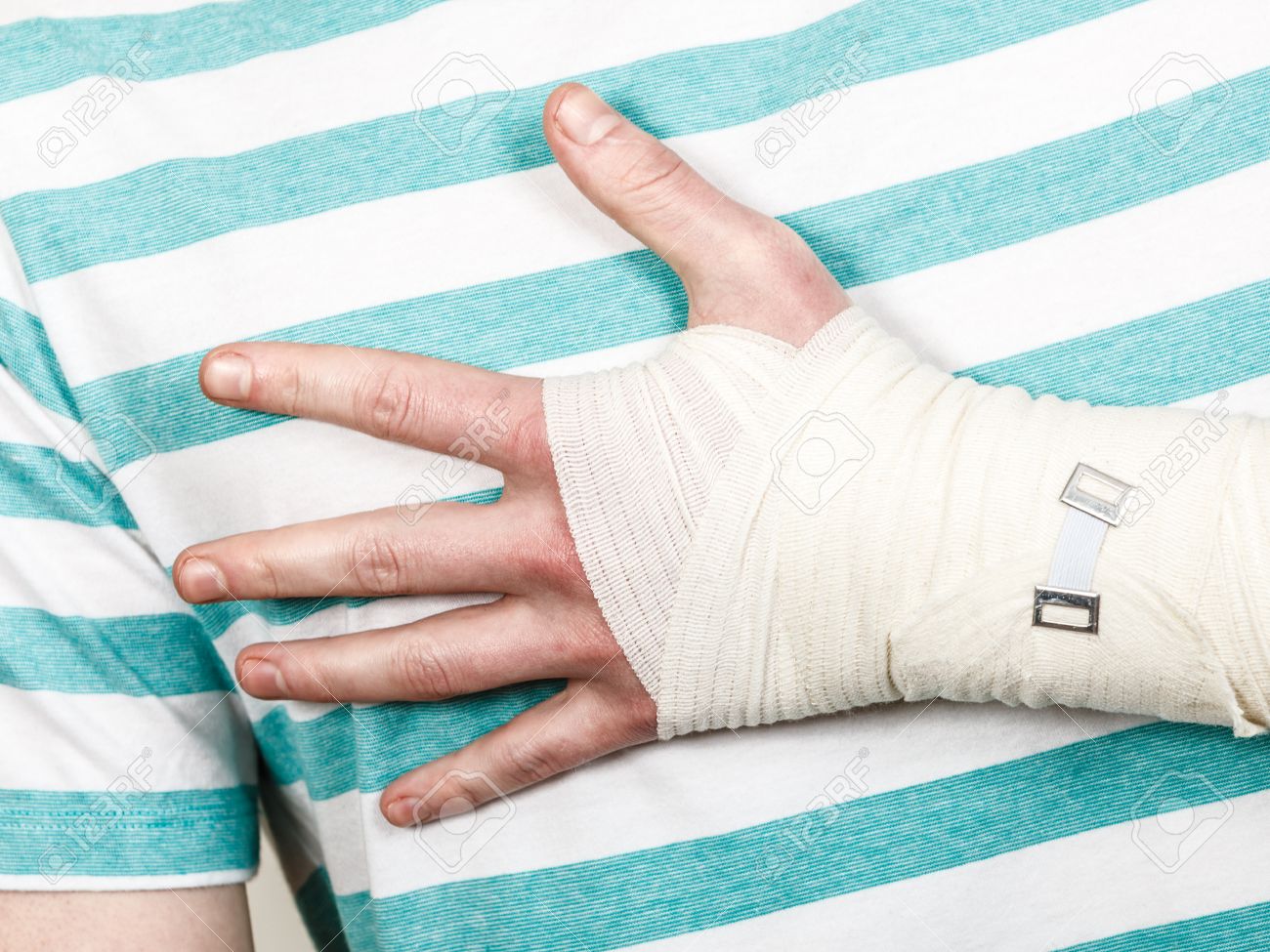 骨折と脱臼のコンセプトです 包帯で手で一部体男性 若い男の痛いヤシ アームの有用な薬 の写真素材 画像素材 Image