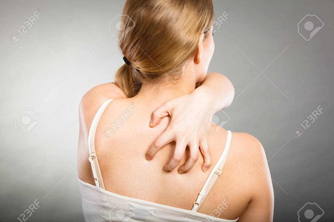 健康上の問題 皮膚病 若い女性アレルギーの発疹のかゆみ背中を掻く の写真素材 画像素材 Image 健康上の問題 皮膚病 若い女性アレルギーの発疹のかゆみ背中を掻く の写真素材 画像素材 Image