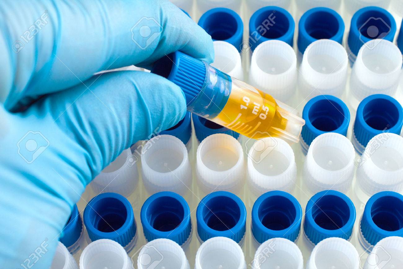 scientist hand with a micro tube rack with biological samples for DNA analysis - 31358147 scientist hand with a micro tube rack with biological samples for DNA analysis - 31358147