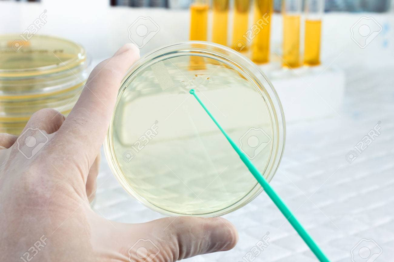 Hand Of Microbiologist Cultivating A Petri Dish Whit Inoculation ... for Inoculation Microbiology
300lyp Hand Of Microbiologist Cultivating A Petri Dish Whit Inoculation ... for Inoculation Microbiology
300lyp