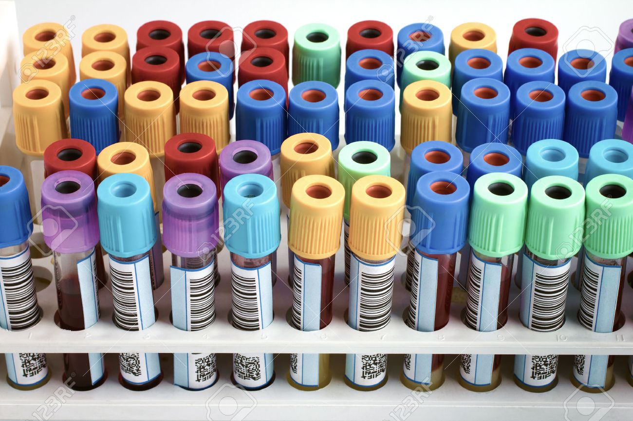 Tubes with bar code for analysis of blood samples in the hospital table rack of blood tubes labeled in blood bank lab - 44609149 Tubes with bar code for analysis of blood samples in the hospital table rack of blood tubes labeled in blood bank lab - 44609149