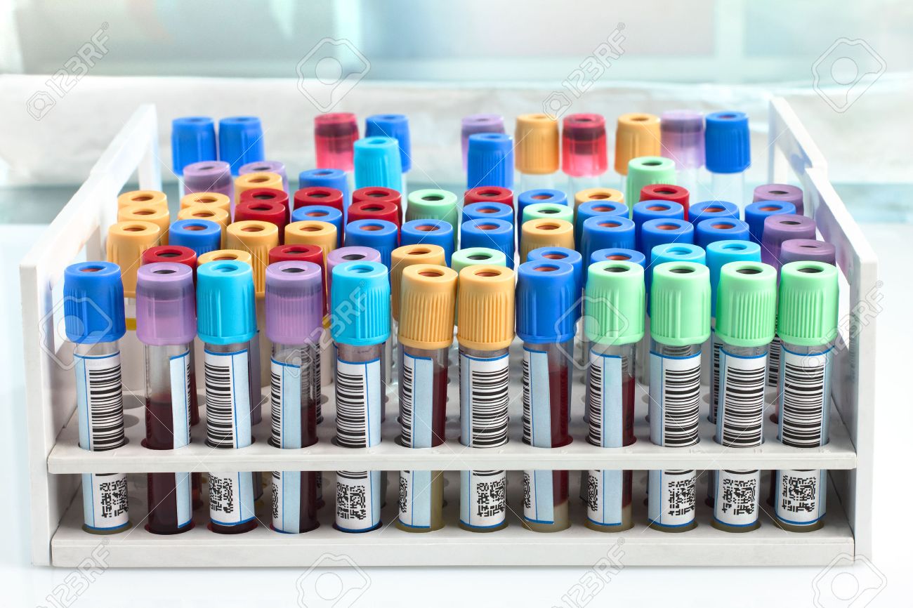 blood tube test for analysis in the laboratory of hematology blood tubes in tray in the lab - 50312984 blood tube test for analysis in the laboratory of hematology blood tubes in tray in the lab - 50312984