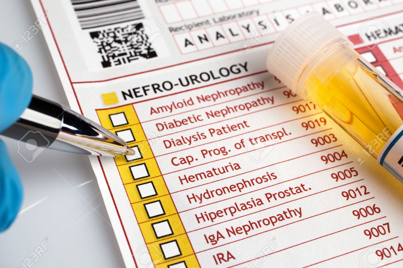 Doctor writing a report of analysis of urine for a patient physician filling medical form of urianalysis diagnostic - 51463136 Doctor writing a report of analysis of urine for a patient physician filling medical form of urianalysis diagnostic - 51463136