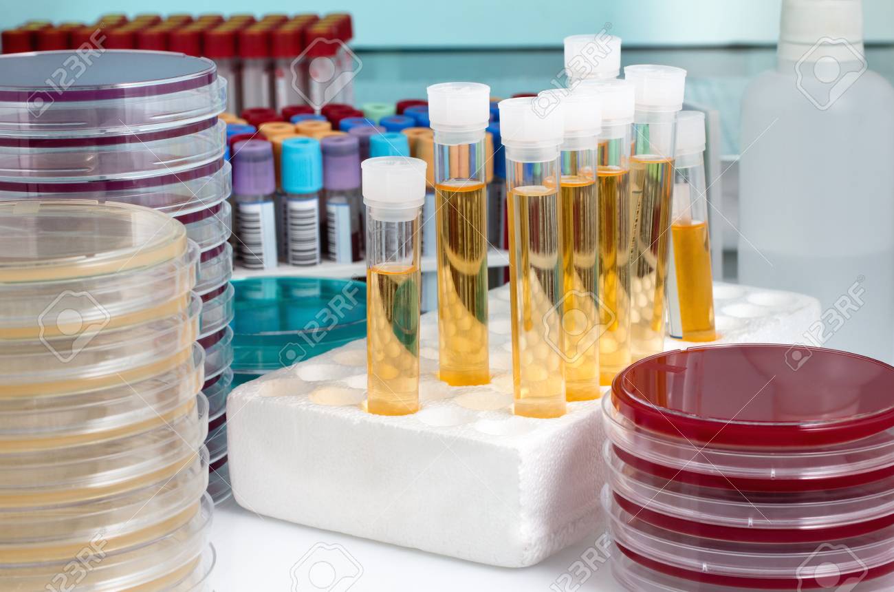 Table De Travail Du Laboratoire De Microbiologie Echantillons Biologiques Sur L Etabli Du Laboratoire D Analyse Banque D Images Et Photos Libres De Droits Image Table De Travail Du Laboratoire De Microbiologie Echantillons Biologiques Sur L Etabli Du Laboratoire D Analyse Banque D Images Et Photos Libres De Droits Image
