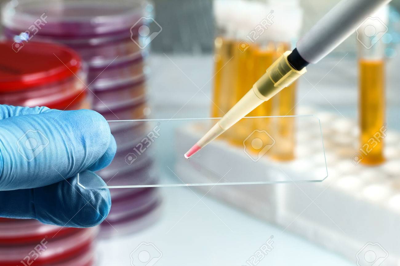 technician preparing sample in slide for microscope / Hand of the lab technician holding a slide and depositing a sample - 78746416 technician preparing sample in slide for microscope / Hand of the lab technician holding a slide and depositing a sample - 78746416