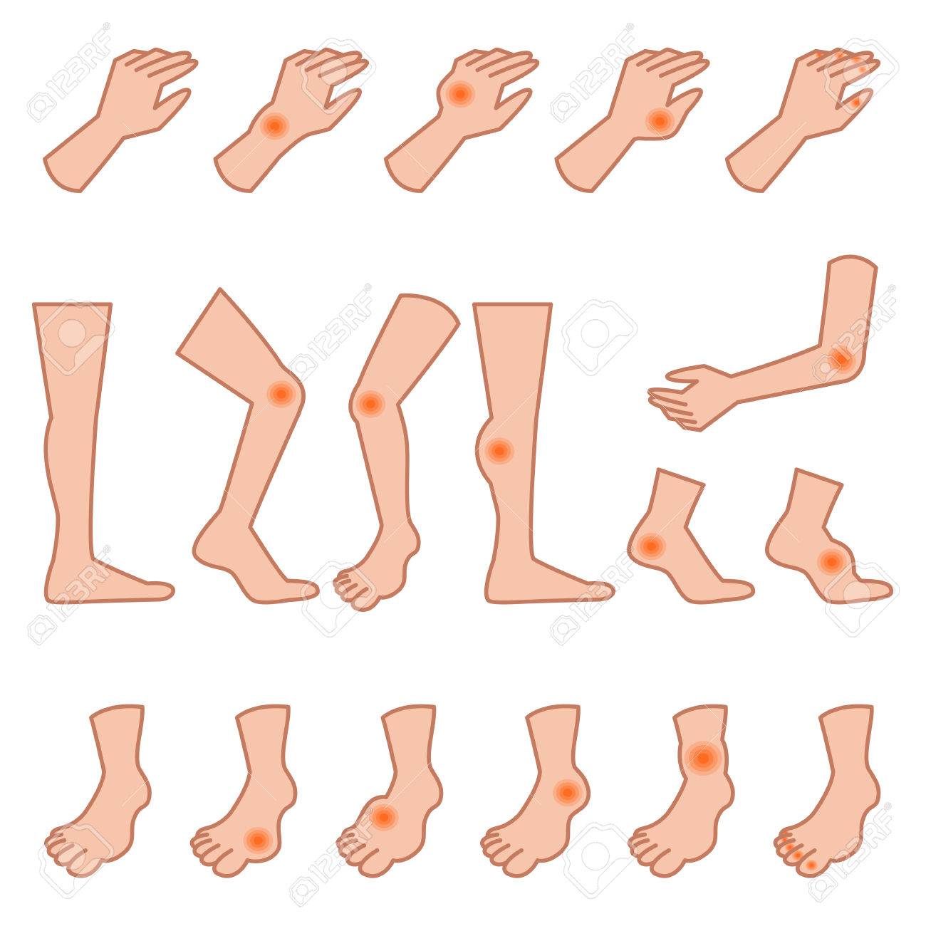 limbs of gout royalty free cliparts vectors and stock illustration