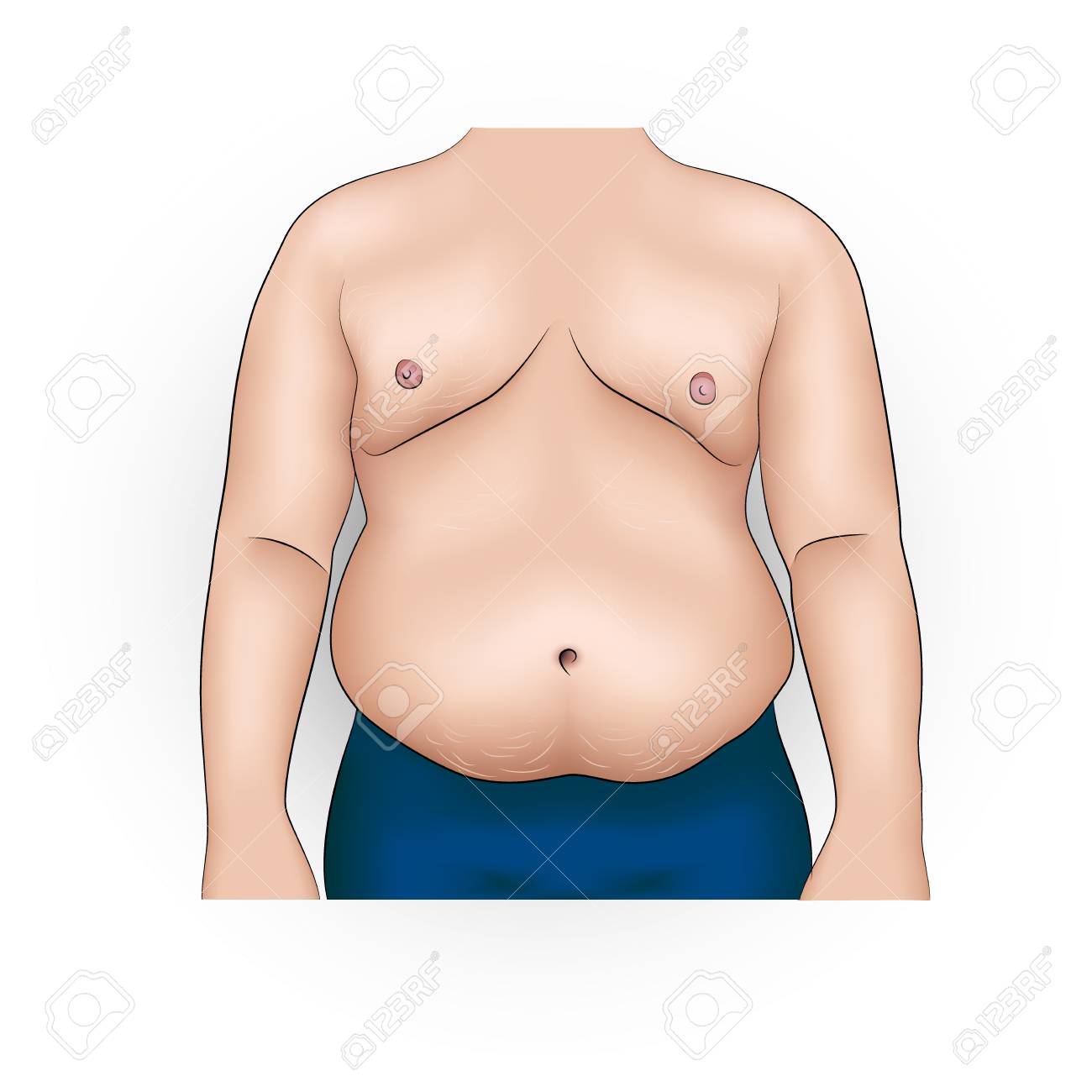肥満と脂肪腹を持つ男の現実的なベクトルイラスト のイラスト素材 ベクタ Image