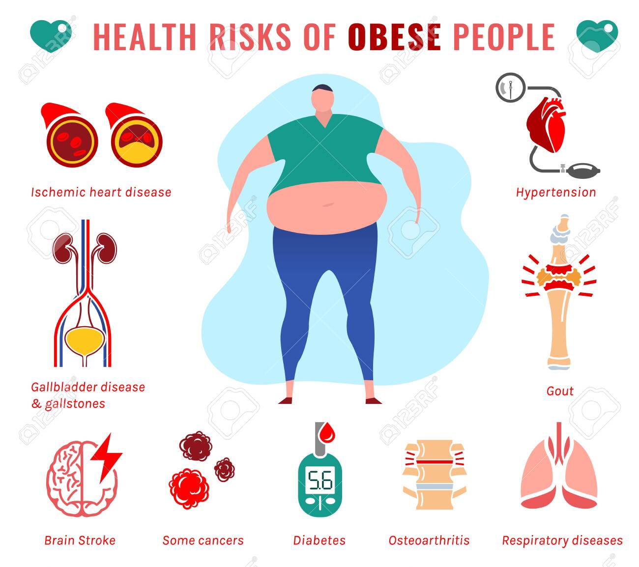 Fat People Disease. Health Risks Of Obese Men. Medical Infographic With  Flat Icons. Unhealthy Behavior. Weight Loss, Obesity, Healthy Nutrition  Concept. Editable Vector Illustration. Horizontal Poster Royalty Free SVG,  Cliparts, Vectors, And
