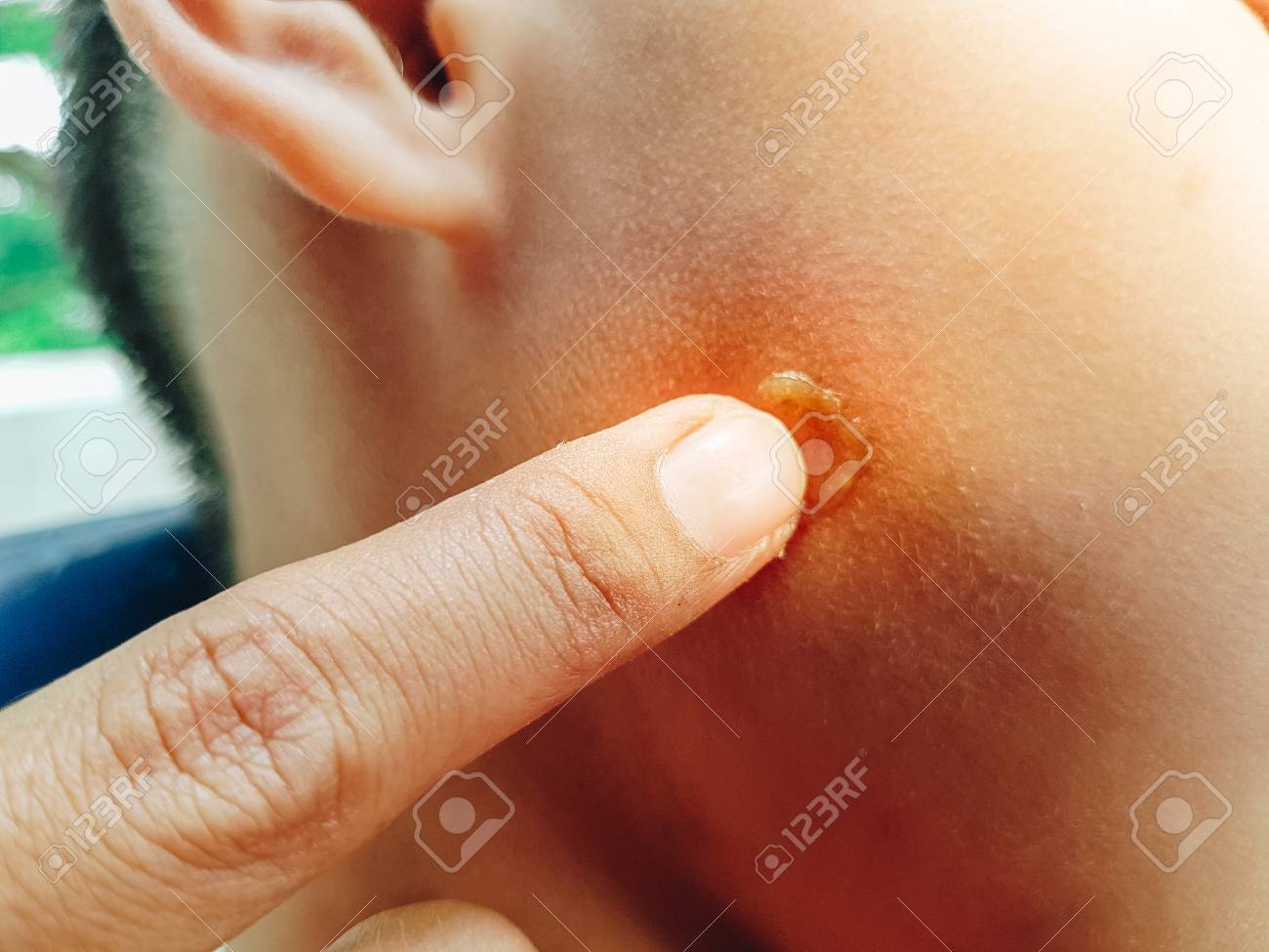 etiam-dictum-ipsum-a-felis