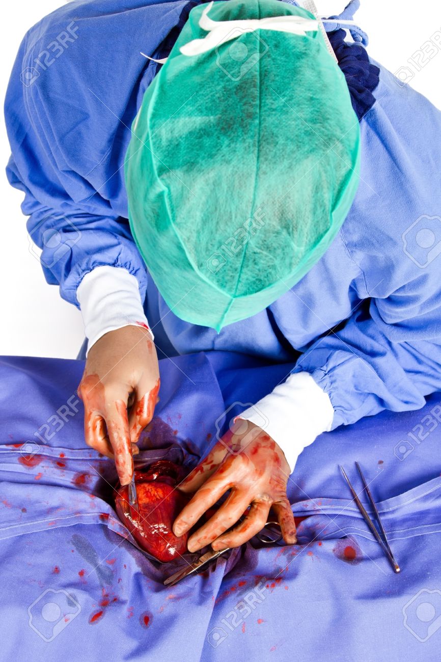 doctor operating on patient heart in blue with tools stock photo