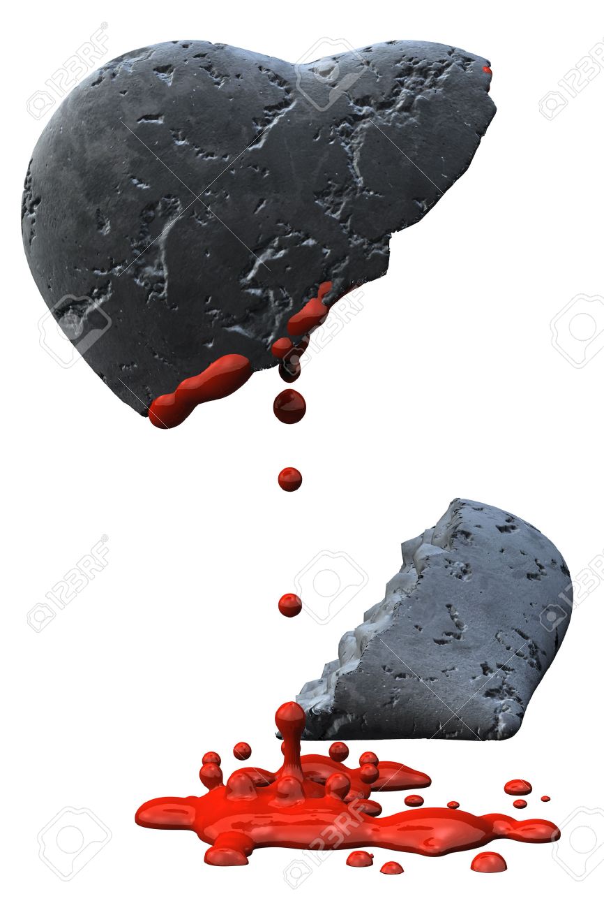 Bleeding Gebrochenes Herz Aus Stein Isoliert Uber Einen Weissen Hintergrund Lizenzfreie Fotos Bilder Und Stock Fotografie Image 1380161