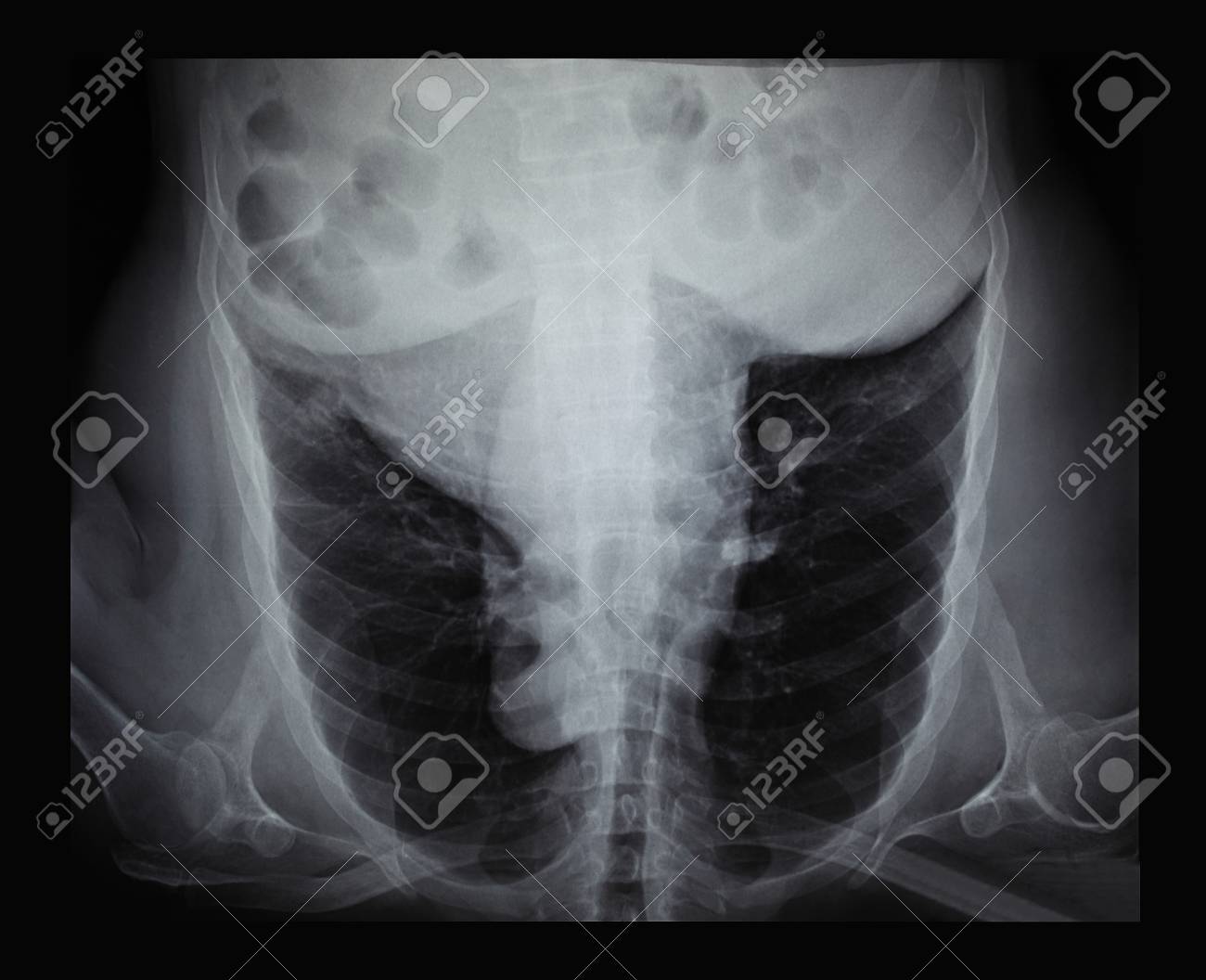 etiam-dictum-ipsum-a-felis