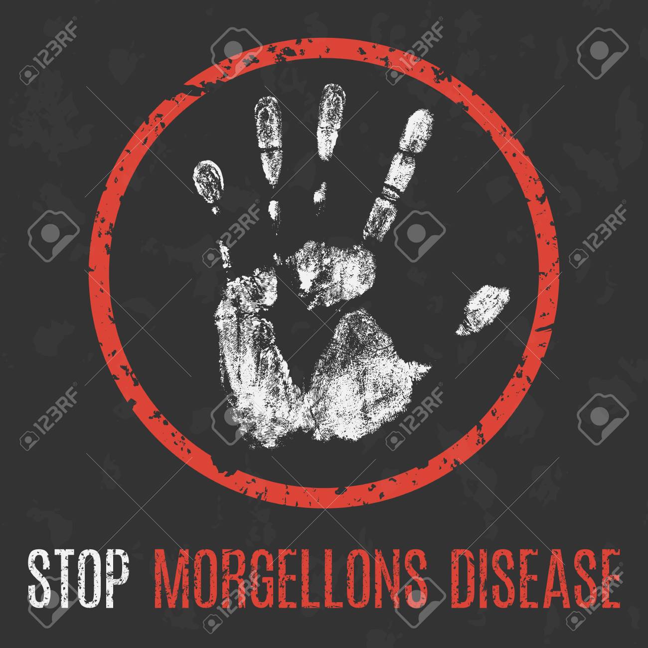 Morgellons Hastalığı Morgellons Hastalığı