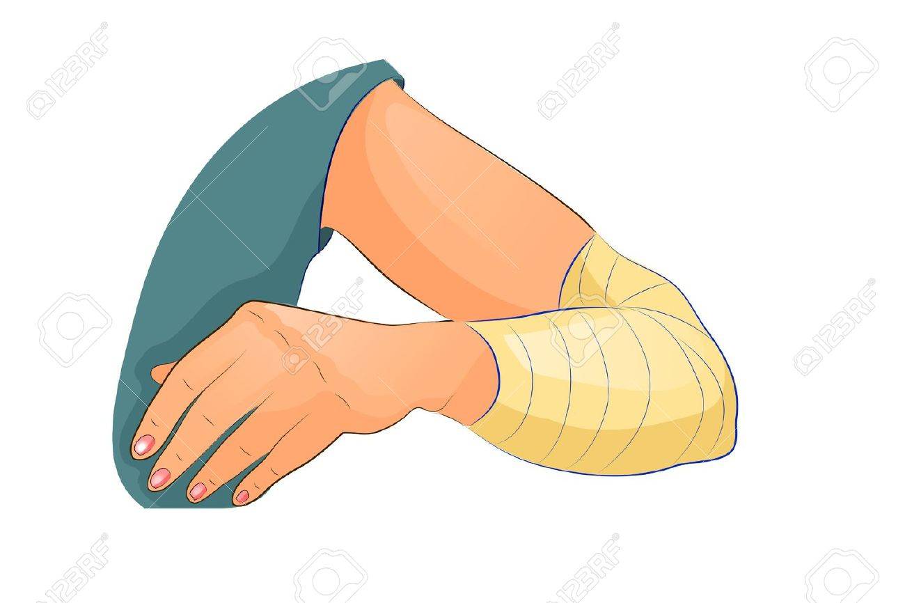 肘に包帯のベクトル イラスト のイラスト素材 ベクタ Image 肘に包帯のベクトル イラスト のイラスト素材 ベクタ Image