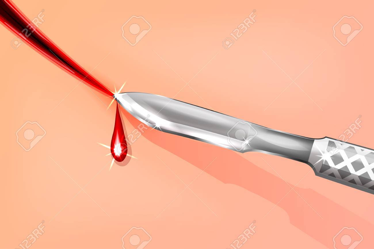 皮膚をメスで切断のベクトル イラストのイラスト素材 ベクタ Image 7210 皮膚をメスで切断のベクトル イラストのイラスト素材 ベクタ Image 7210