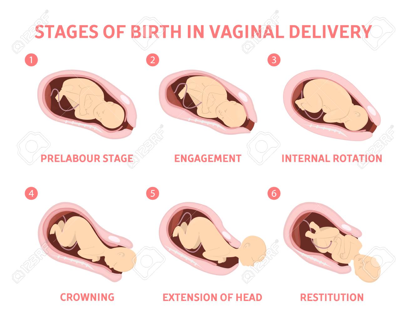 stages of baby birth in vaginal delivery fetus movement during labor stages