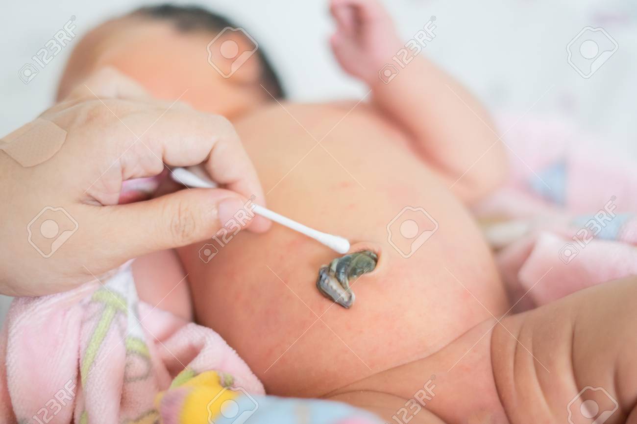 Les Medecins Les Infirmieres Utilisent Un Coton Tige Imbibe D Alcool Pour Essuyer Le Bebe Du Cordon Ombilical Du Nombril Couleur Vintage Mise Au Point Selective Banque D Images Et Photos Libres De Droits Image