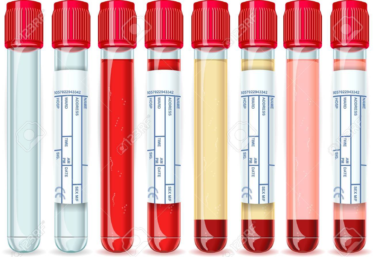 Detailed Illustration Of A Red Cap Tube With Six Possible Uses Royalty Free Cliparts Vectors And Stock Illustration Image 22423698