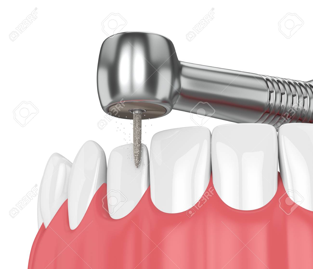 3d render of jaw