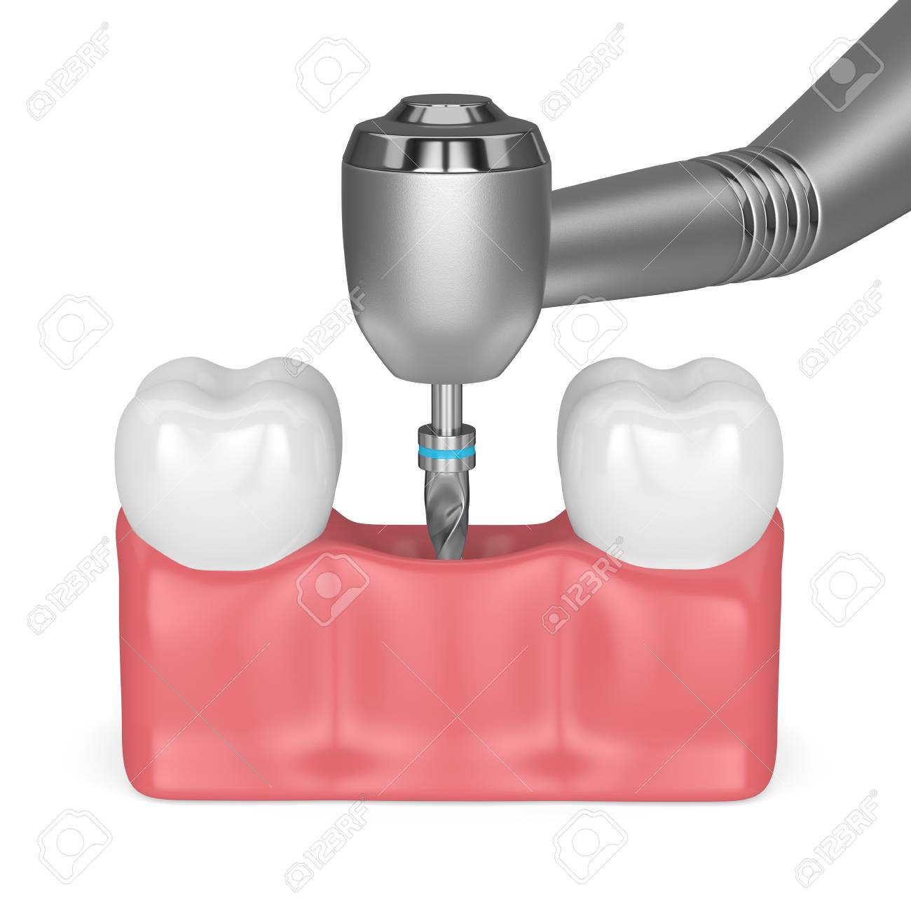 3d render of teeth