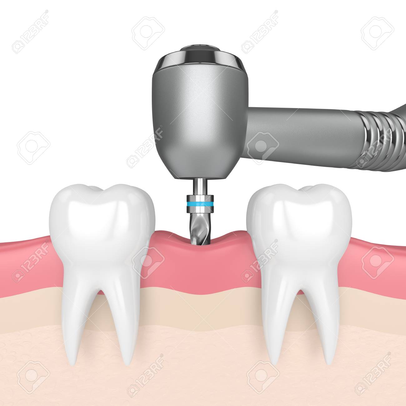 3d render of teeth