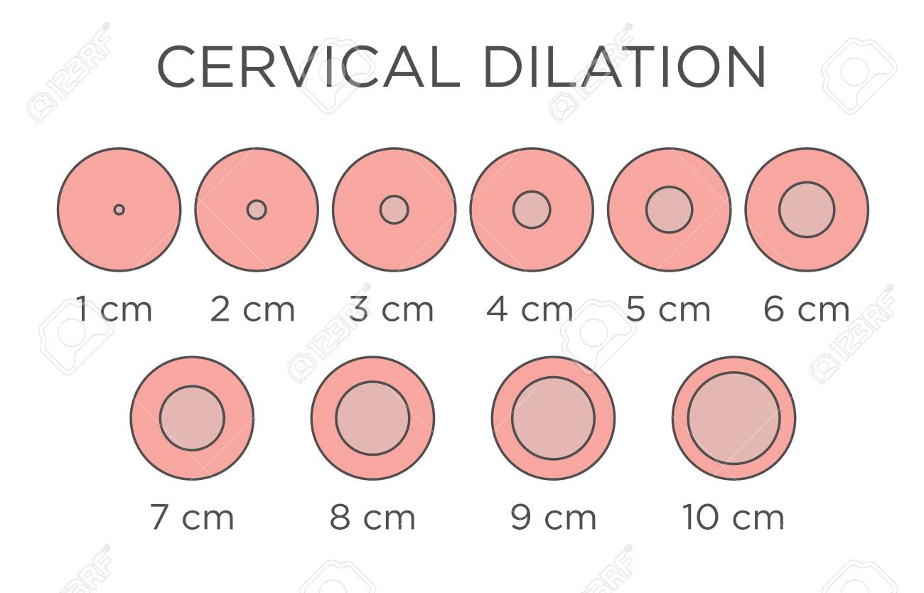 Birth Dilation Chart